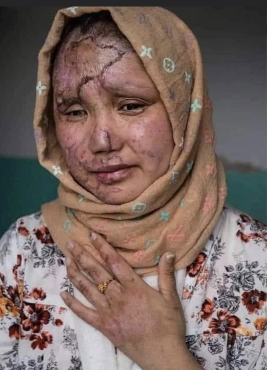 FarhatParwiz's tweet photo. #StopHazaraGenocide https://t.co/FAIExUZogQ
