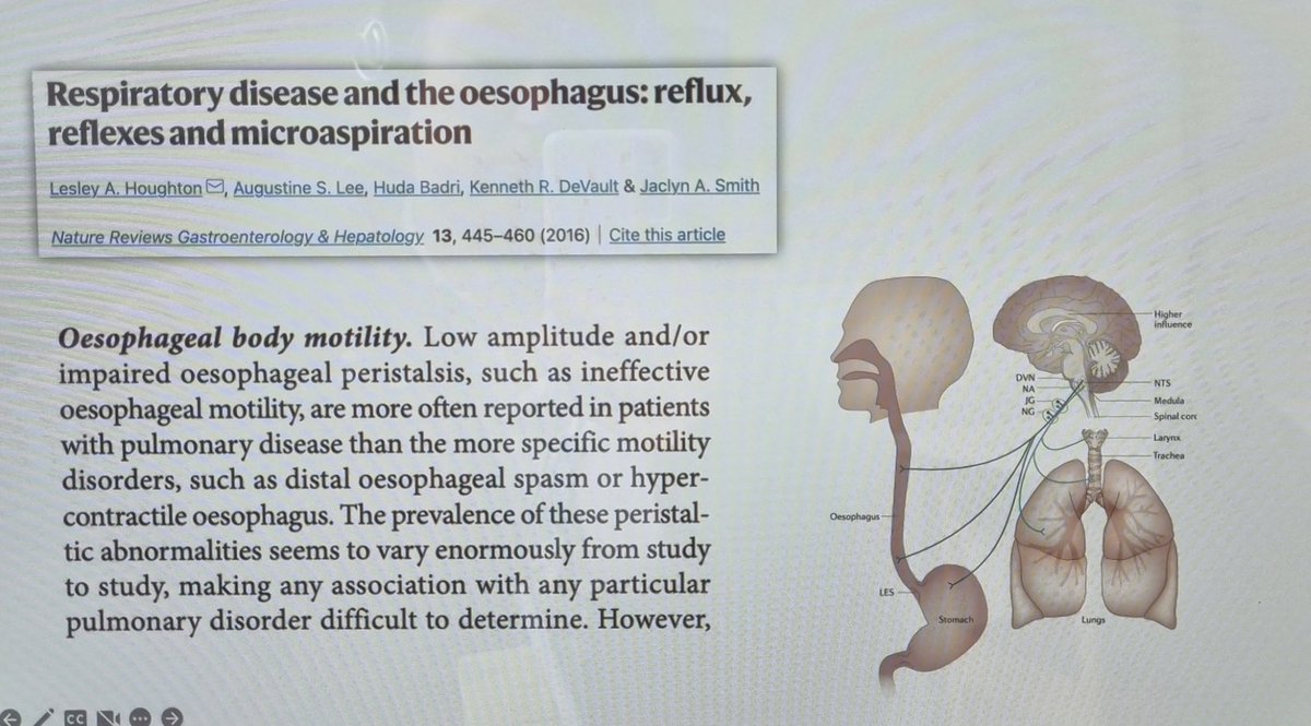 Now listening to <a href="/L33Bolton/">Lee Bolton (he/him) 🇪🇺🏳️‍🌈🏳️‍⚧️🕊️</a> outlining the complex and essential relationship between respiratory, swallow and oesphageal function and why as SLT's we should be exploring this more. #innovative