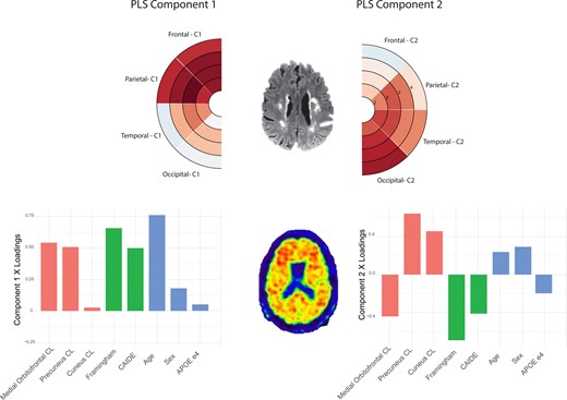Lorenzini et al. describe two distinct regional patterns of association between white matter hyperintensities and early amyloid deposition, differentially related to vascular risk factors and cognitive performance. bit.ly/3rrIurt