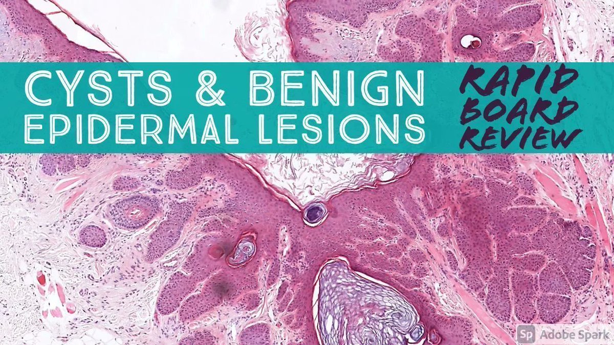 Jerad Gardner, MD on Twitter "Benign Epidermal Lesions & Cysts Rapid Board Review Video https