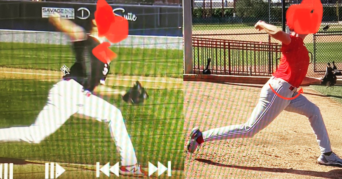 drjreiner's tweet image. Before:R side remains “open.”       ⬇️ER’s and IR’s of thorax/pelvis.       After:Focused on restoring thorax/pelvis ER (space) before addressing IR (compression). Then worked “early” IR (getting into his load) followed by “late” IR (getting out of the back leg). #processmatters