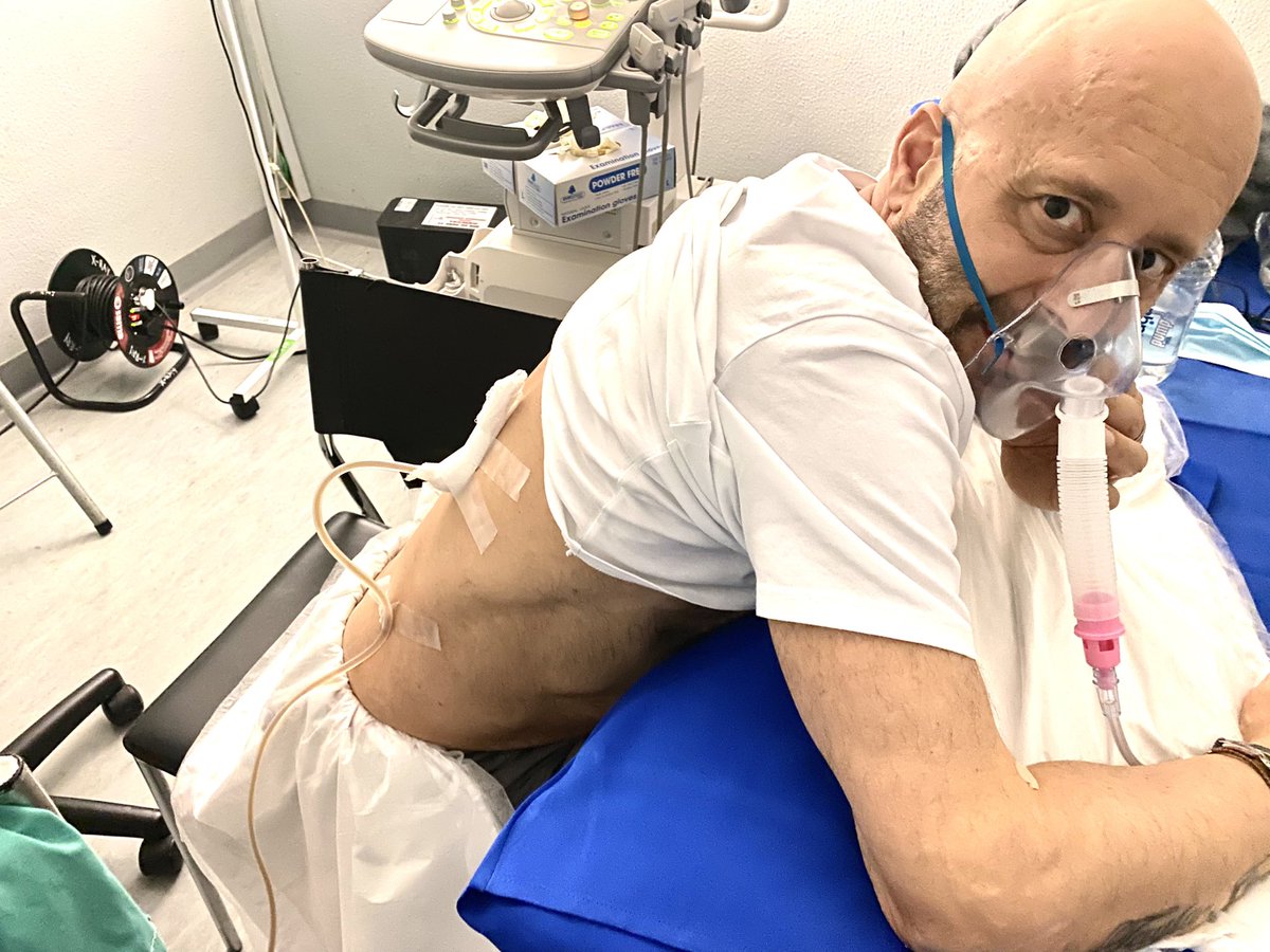 MarkPilgrimZA's tweet photo. Not too different from siphoning petrol from a car… except the doctor’s lips aren’t sucking the pipe 😊

Allowing a collapsed lung to start working again by draining  a few liters of fluid from the chest cavity 🥴.

Looking forward to breathing and talking normally again! https://t.co/cNKwqd6lPo