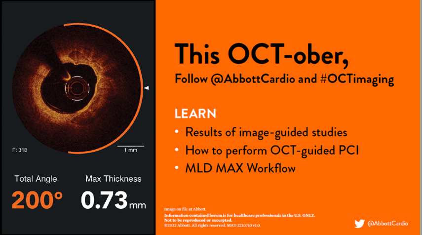 Abbott Cardiovascular tweet media