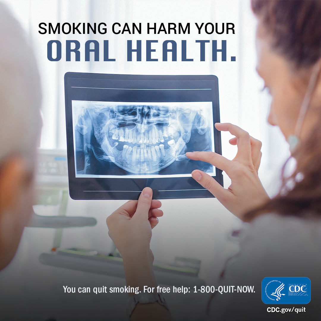 JCIowaPH's tweet photo. October is National Dental Hygiene Month. Did you know that smoking can cause harm to your oral health. For help quitting you can call 800-Quit-Now or https://t.co/sB3C7SBofs #QuitlineIowa #Quit4Good https://t.co/zvCCkSR01e