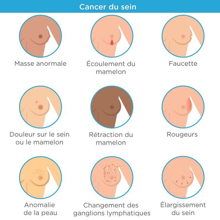 𝕄𝕣 𝕜𝕖𝕖𝕓𝕖 🇨🇩 tweet media