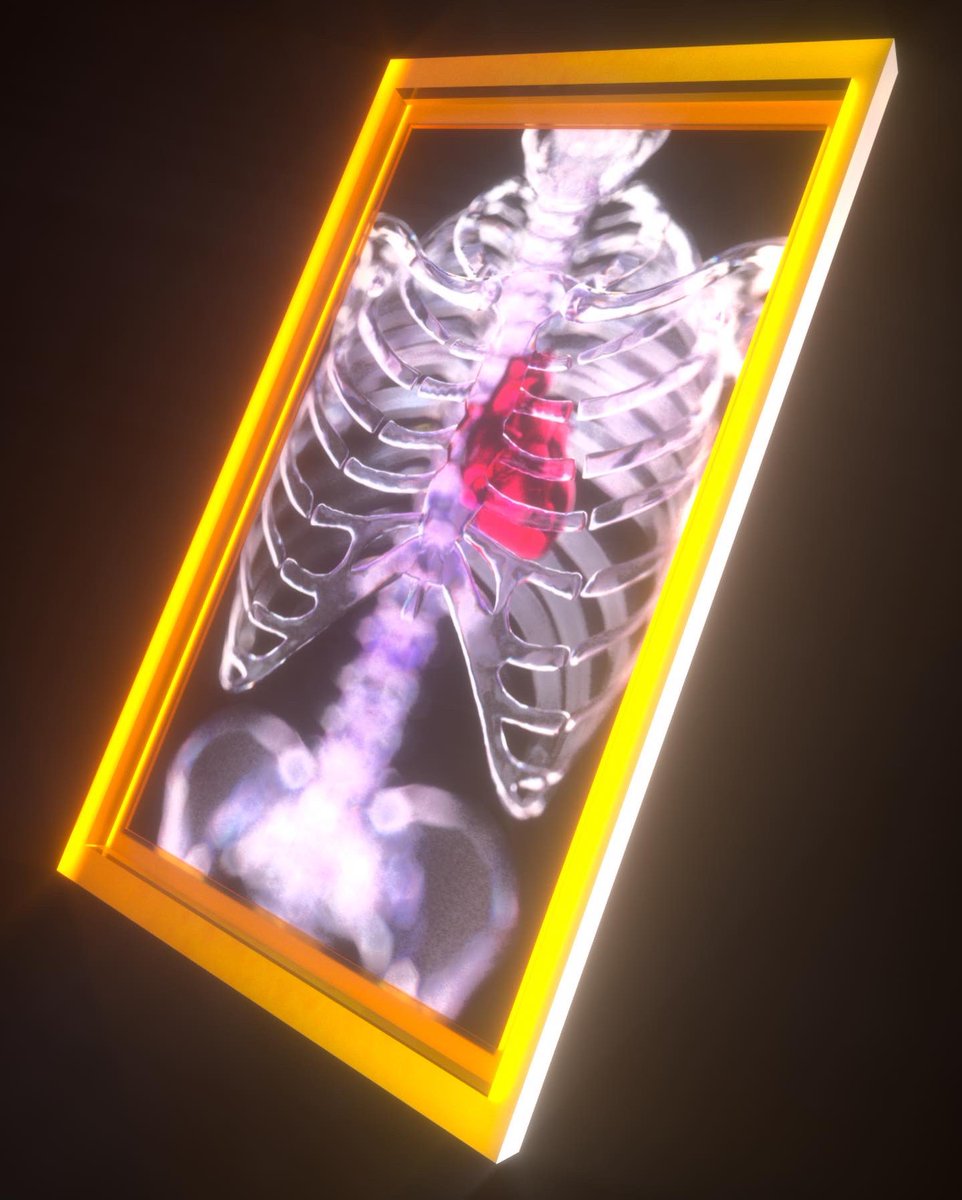 RUNO (@jxruno) on Twitter photo 