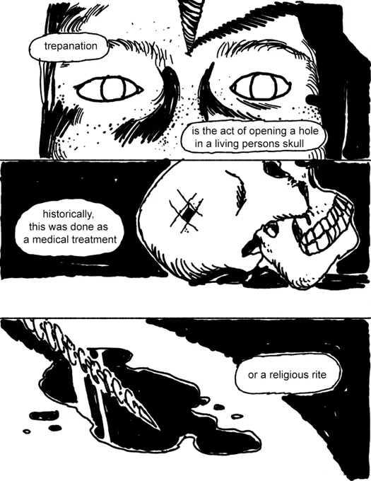 No, I Won't Drill a Hole in My Head (1/4) 