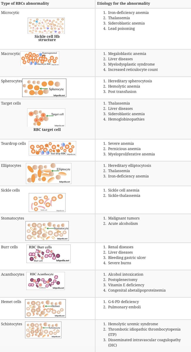 Innov_Medicine's tweet photo. RBC morphology atlas (https://t.co/hLZiDzoot5) #BJHM #MedEd #Medtwitter h/t @BrownJHM https://t.co/BpiGkfFzjp