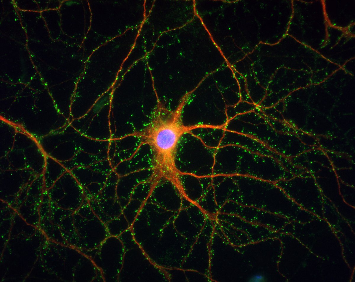 RFK IDDRC (@rfk_iddrc) on Twitter photo Looking for a postdoc? Interested in research on neurodevelopmental disorders? Apply for our #T32 fellowship to work with one of 30 labs at <a href="/EinsteinMed/">Albert Einstein College of Medicine - Official</a> bit.ly/3BMQB72 Looking for a postdoc? Interested in research on neurodevelopmental disorders? Apply for our #T32 fellowship to work with one of 30 labs at <a href="/EinsteinMed/">Albert Einstein College of Medicine - Official</a> bit.ly/3BMQB72
