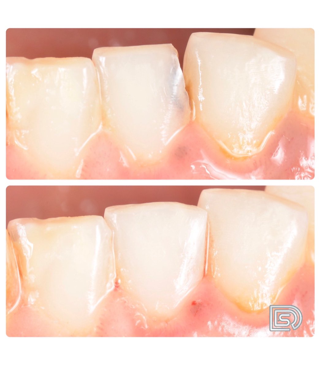 لمسات تجميلية بسيطة تصنع الفرق ✨🤍