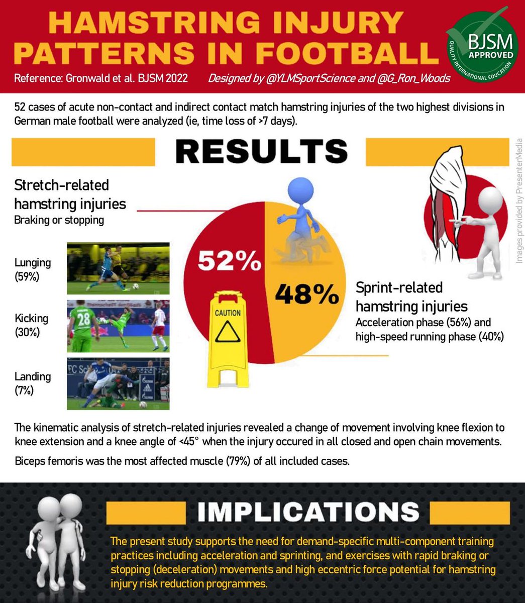 ⚽️ Do you want to learn more about the patterns of hamstring injury in football? ⚽️ Excellent #Infographic 📈 from the #CurrentIssue which summarises findings from a study that used video analysis of injuries 📹 What are the important implications? 👉 bit.ly/3CyhDk7