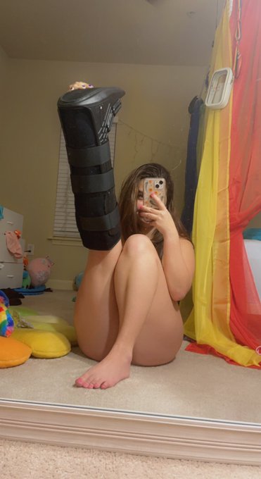 bad news i broke my foot, good news dr told me to stretch🥰 https://t.co/BLhzJgnh1E