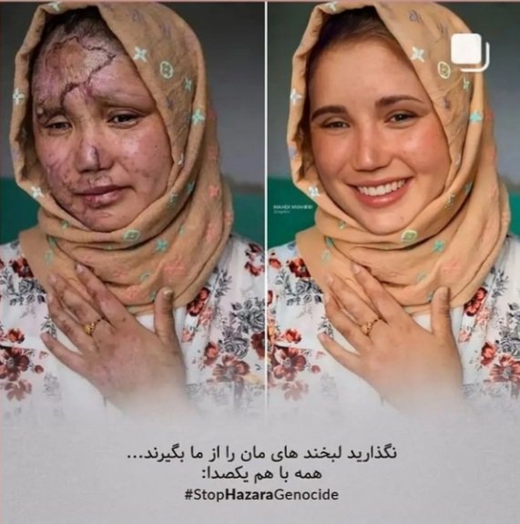 Fatima80943628's tweet photo. زنها تنها برای حق خود می‌جنگند در سرزمین افغانستان مرد های با غیرت که غیرت شان فقط  ظلم بر زنان خلاصه می‌شود روزی اگر افغانستان آزاد شد بگذارید یک زن رئیس‌جمهور شود آن هم یک زن هزاره چون تا به حال زنان هزاره اند که در کوچه خیابان های کابل دست خالی از حق همه ما دفاع کرده و میکنه https://t.co/AEtbNx8zxc