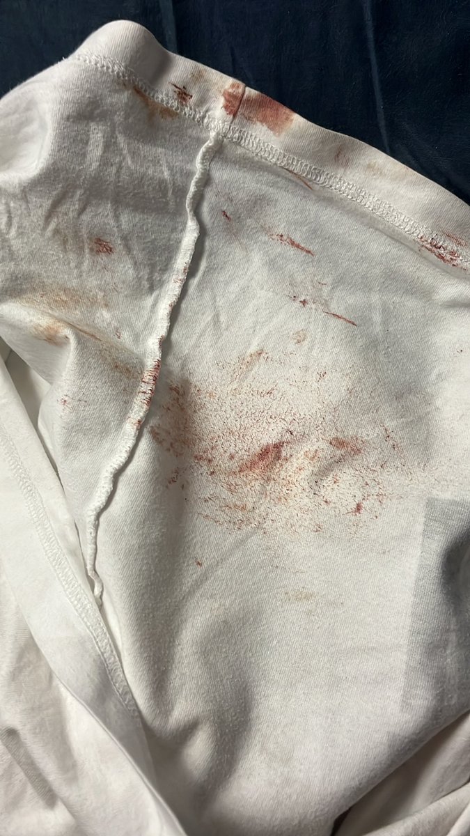 今日事故ったんだけど血がドバドバ出てくるせいで着替えたばっかなのにこんなんなになっちゃった