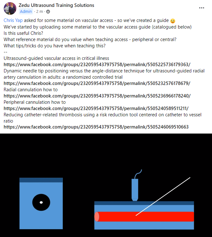 zedunow's tweet photo. .@casualtysrus
You asked, we delivered 😁
We've added vascular access resources to the #POCUS educator / #USSEED #SEED support network
What reference material do you value?
What tips/tricks do you use?
Join the crew, learn & share
https://t.co/wJYspGftEz
#ultrasound #MedTwitter https://t.co/xu7KPl03Mu