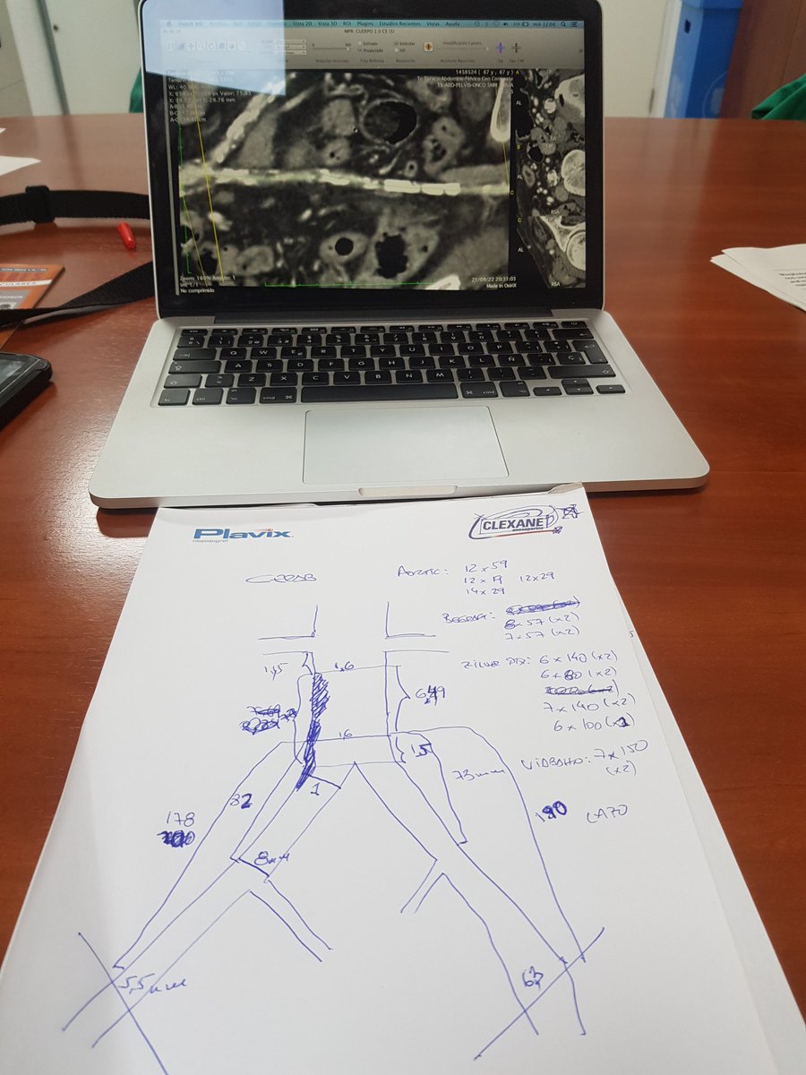 Hoy toca #CERAB compleja.
#VascularSurgery #CirugiaVascular