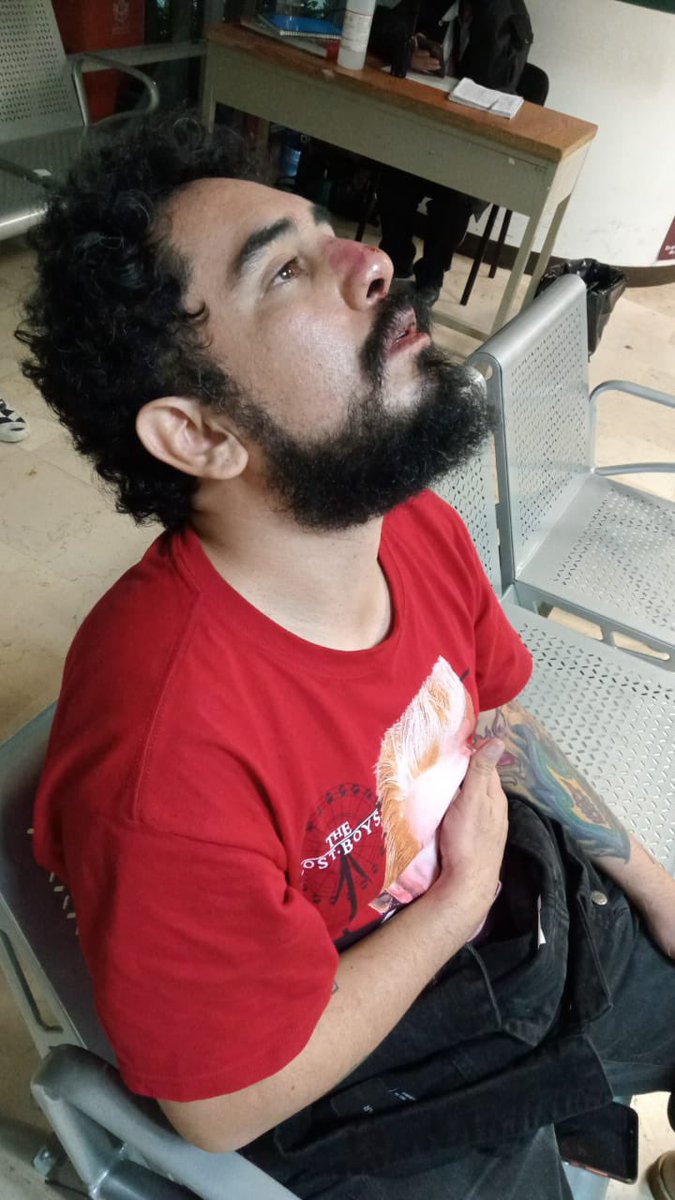 Karushifa's tweet photo. Oye @Ticketmaster_Me y Ocesa ¿van a responder por lo que uno de sus trabajadores de seguridad le hizo esto a mi hermano solo por estar bailando? Golpearon a mi hermano, tiraron a mi papá y a mi me jalonearon, parearon, dejaron marcas en el cuello y tiraron mi celular. 

RESPONDAN https://t.co/NViPNGkRVZ