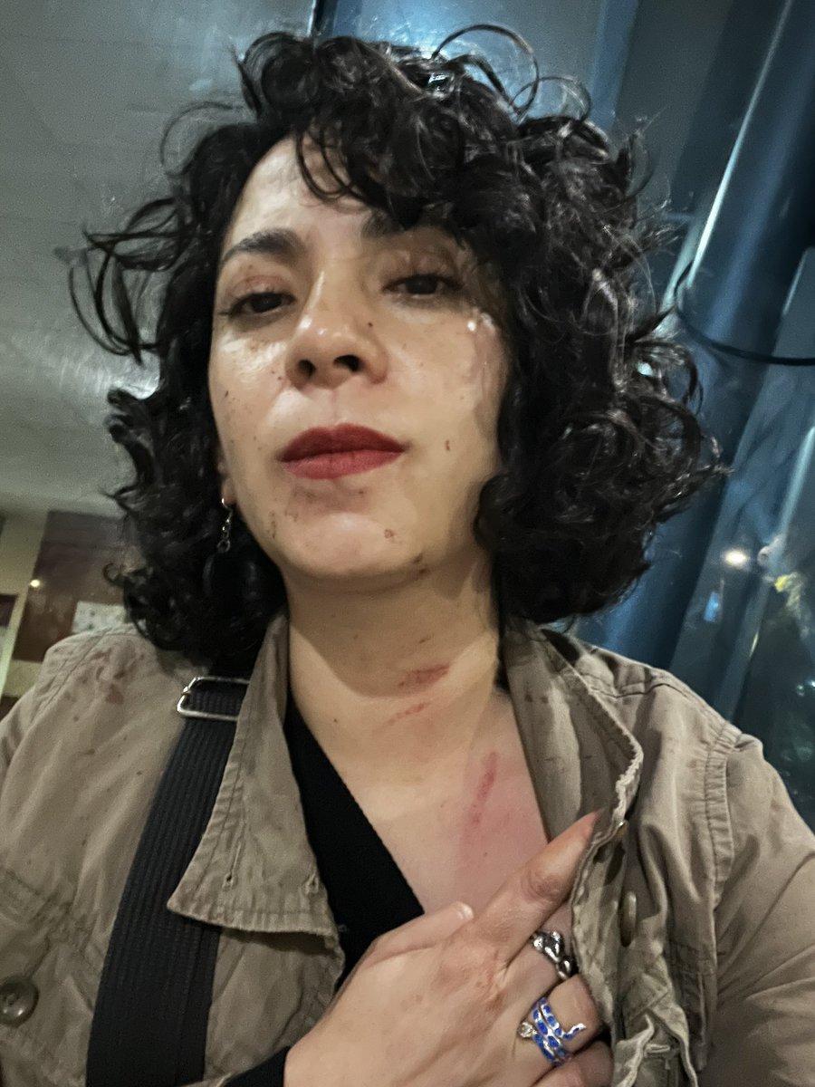 Karushifa's tweet photo. Oye @Ticketmaster_Me y Ocesa ¿van a responder por lo que uno de sus trabajadores de seguridad le hizo esto a mi hermano solo por estar bailando? Golpearon a mi hermano, tiraron a mi papá y a mi me jalonearon, parearon, dejaron marcas en el cuello y tiraron mi celular. 

RESPONDAN https://t.co/NViPNGkRVZ