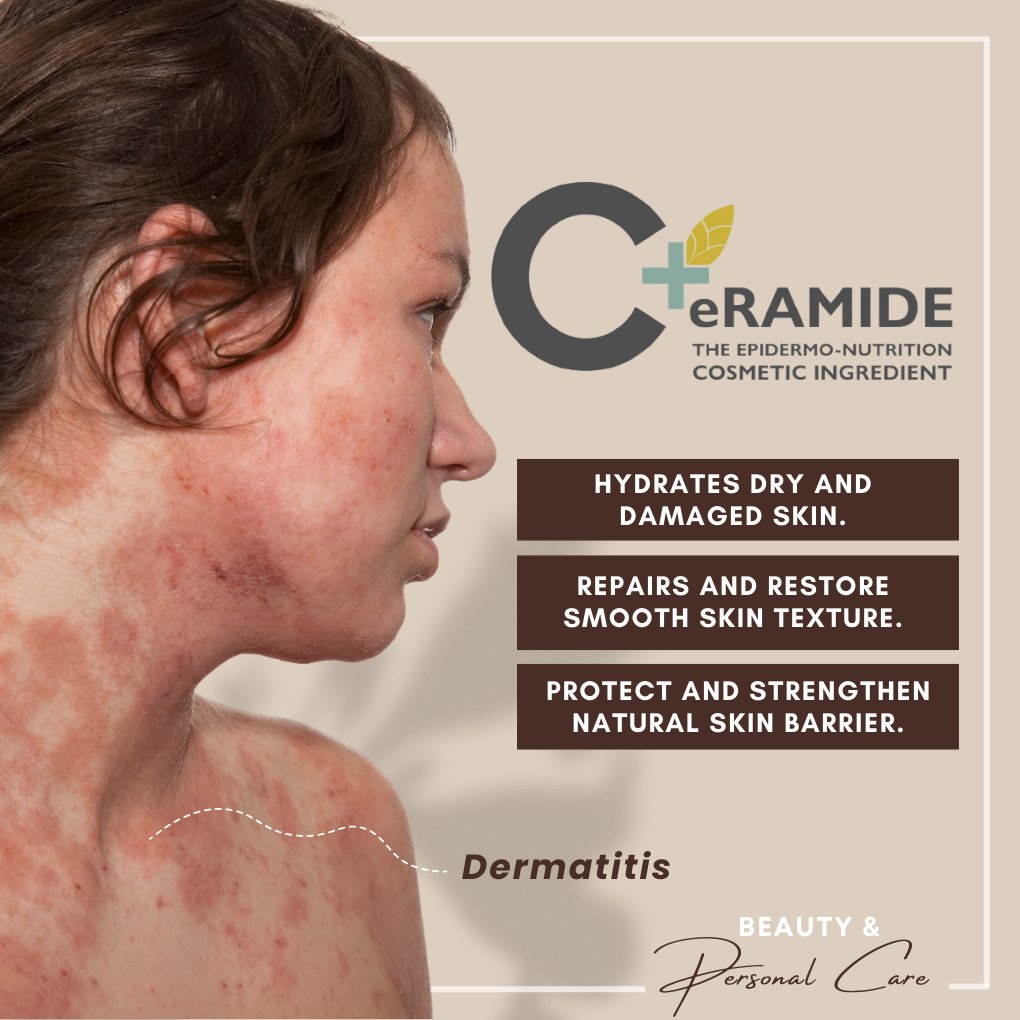 ctcgroup_ph's tweet photo. Years of clinical research and innovation gave birth to the discovery of 3 powerful Beauty ingredients that will help unlock your natural beauty, achieve the elegance that you deserve and keep your healthy-looking and glowing skin for ages.  

Contact us to know more. https://t.co/hmR1PW5YOu