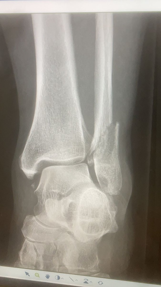 Sundays little miss hap…🦴😩