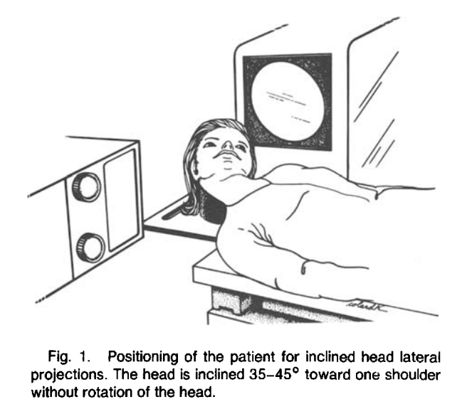 DrPatchiz's tweet photo. Figure from Haughton's original paper "Lateral projection with inclined head for angiography of basal cerebral aneurysms." Just so we remember how good we have it.........potential for a new tiktok dance craze? https://t.co/stz4hYQzrI