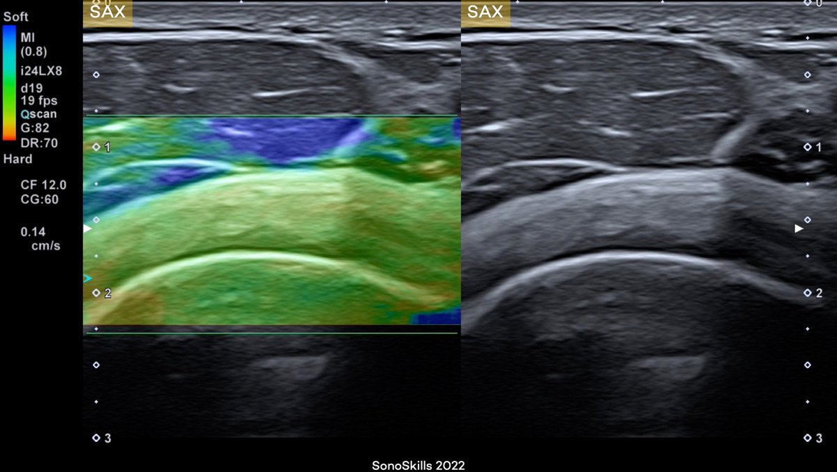 SonoSkills tweet media