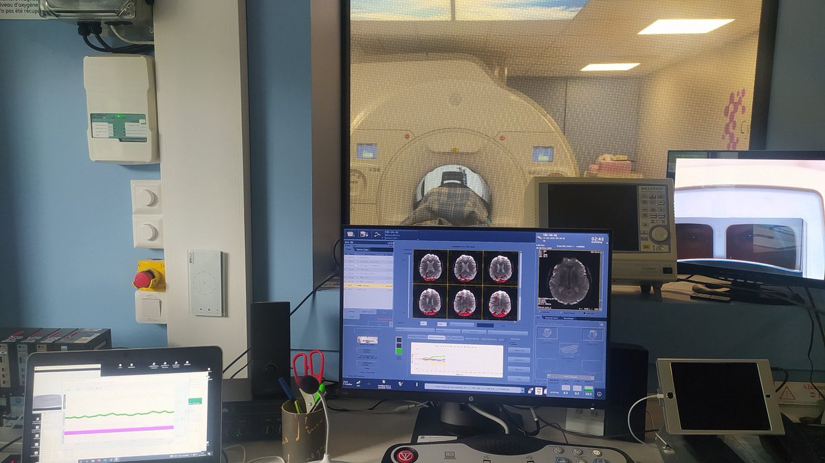 Premier jour d'experimentations de l'équipe COMETE avec l'association  AFVBI pour comprendre comment les patients avec des troubles vestibulaires interagissent avec le monde <a href="/RegionNormandie/">Région Normandie</a> <a href="/InsermNordOuest/">Inserm Nord Ouest</a> <a href="/Cyceron14/">CYCERON</a> <a href="/Universite_Caen/">Université de Caen Normandie</a> #ChaireDExcellence