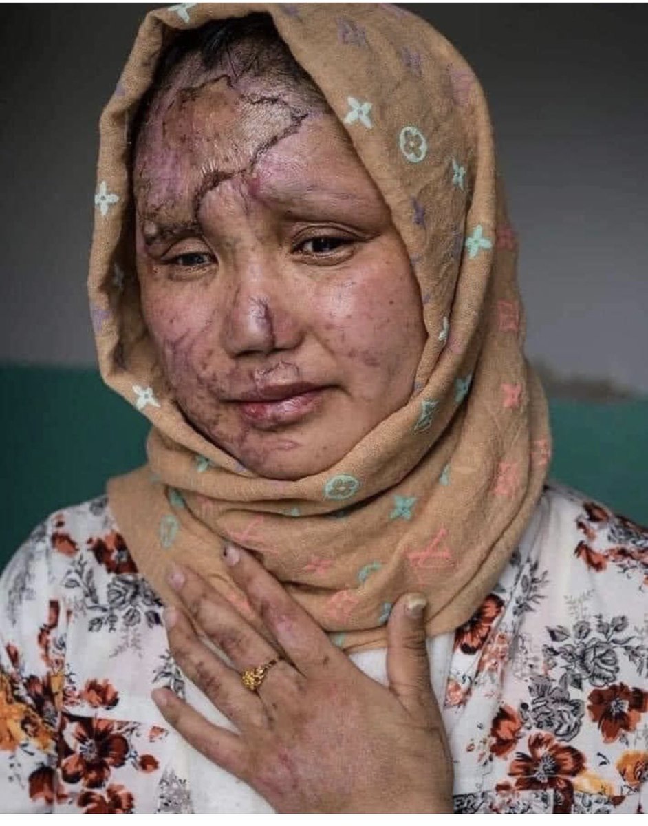 مثل یک بچهٔ آهوکه به جنگل مینهدپا 
آمدم یکه و تنها بین ددها و بلاها 
من وکفتار قدیمی ،من وجنگ نابرابر
من و نیش‌ مارسمی،من وحمله های اژدر
من و زخم طعنه خوردن،من مردن ونمردن 
من و طعم تلخ باختن،من ولج کردن و بردن…!
#StopHazaraGenocide 
#LetAfganGirlsLearn