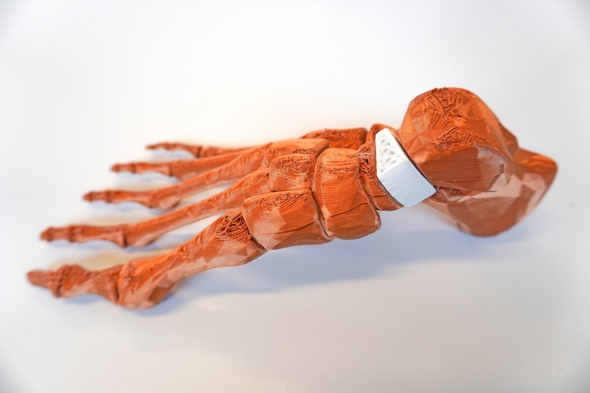 <a href="/Ossiform_com/">Ossiform</a> is pleased to announce that it has completed a £6 million capital raise through <a href="/WestHillCapital/">West Hill Capital</a> 

ossiform.com/news/news/ossi…