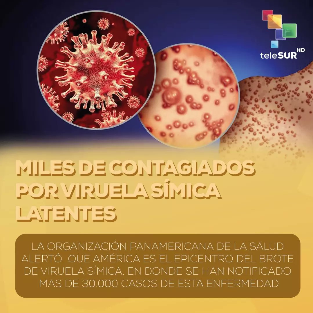 guiatucuerpotls's tweet photo. La #viruela símica es una #enfermedad zoonótica viral, causada por la infección del #virus #transmisible de animales a humanos y también se puede #propagar de persona a persona.
.
.
#ViruelaSimica #enfermedad #virus #animales #persona #laboratorio #vacunas #AméricaLatina #Caribe https://t.co/TldCEiVLJs