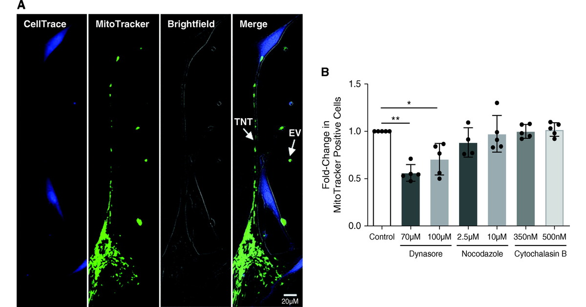 Mitochondrial Transfer Regulates Bioenergetics in Healthy and Chronic Obstructive Pulmonary Disease Airway Smooth Muscle

🔗 bit.ly/3fxUvc9