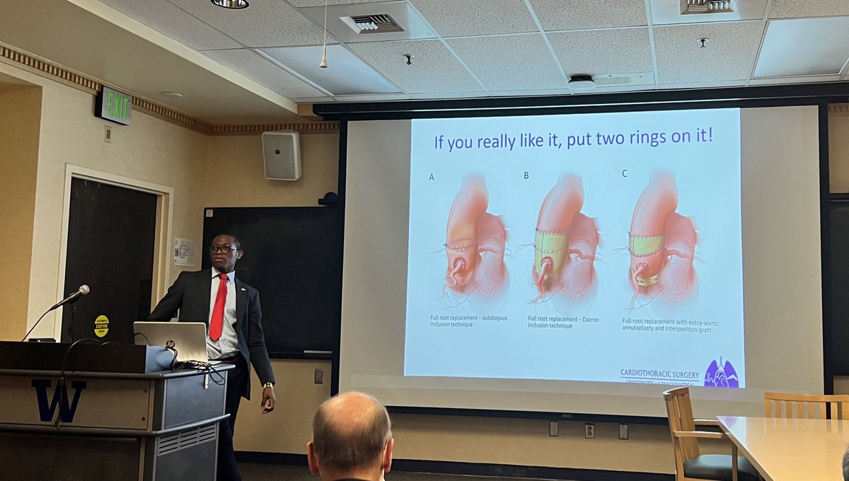 Univ. of Washington Cardiology Fellows (@uwashfellows) on Twitter photo Fantastic Multidisciplinary Conference this morning from cardiothoracic surgical fellow <a href="/callistusditah/">Callistus Ditah</a> (<a href="/UWCTSurgRes/">UW CT Surgery Residency</a>) discussing contemporary experience with the Ross procedure. Fantastic Multidisciplinary Conference this morning from cardiothoracic surgical fellow <a href="/callistusditah/">Callistus Ditah</a> (<a href="/UWCTSurgRes/">UW CT Surgery Residency</a>) discussing contemporary experience with the Ross procedure.
