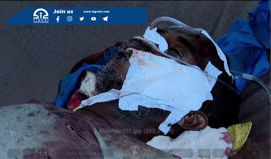 Tigrai_TV's tweet photo. #Update 
65 Civilians Confirmed Dead 
---
65 killed and several more wounded in a #DroneAttack conducted on IDPs in AdiDaero on Tuesday

To be updated.

#AdiDaeroMassacre #AdiDaeo #Tigray #TigrayWar https://t.co/UKI9ZadGwT