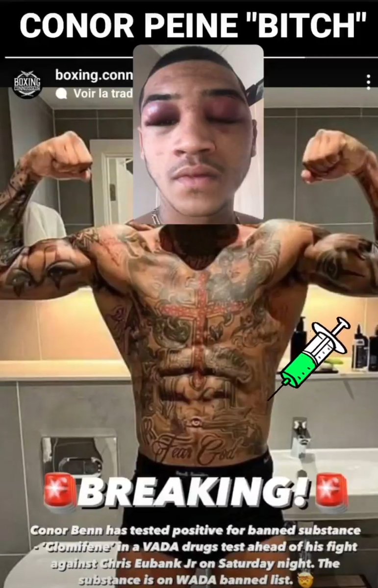 💉👏🏻🤣🤣🤣