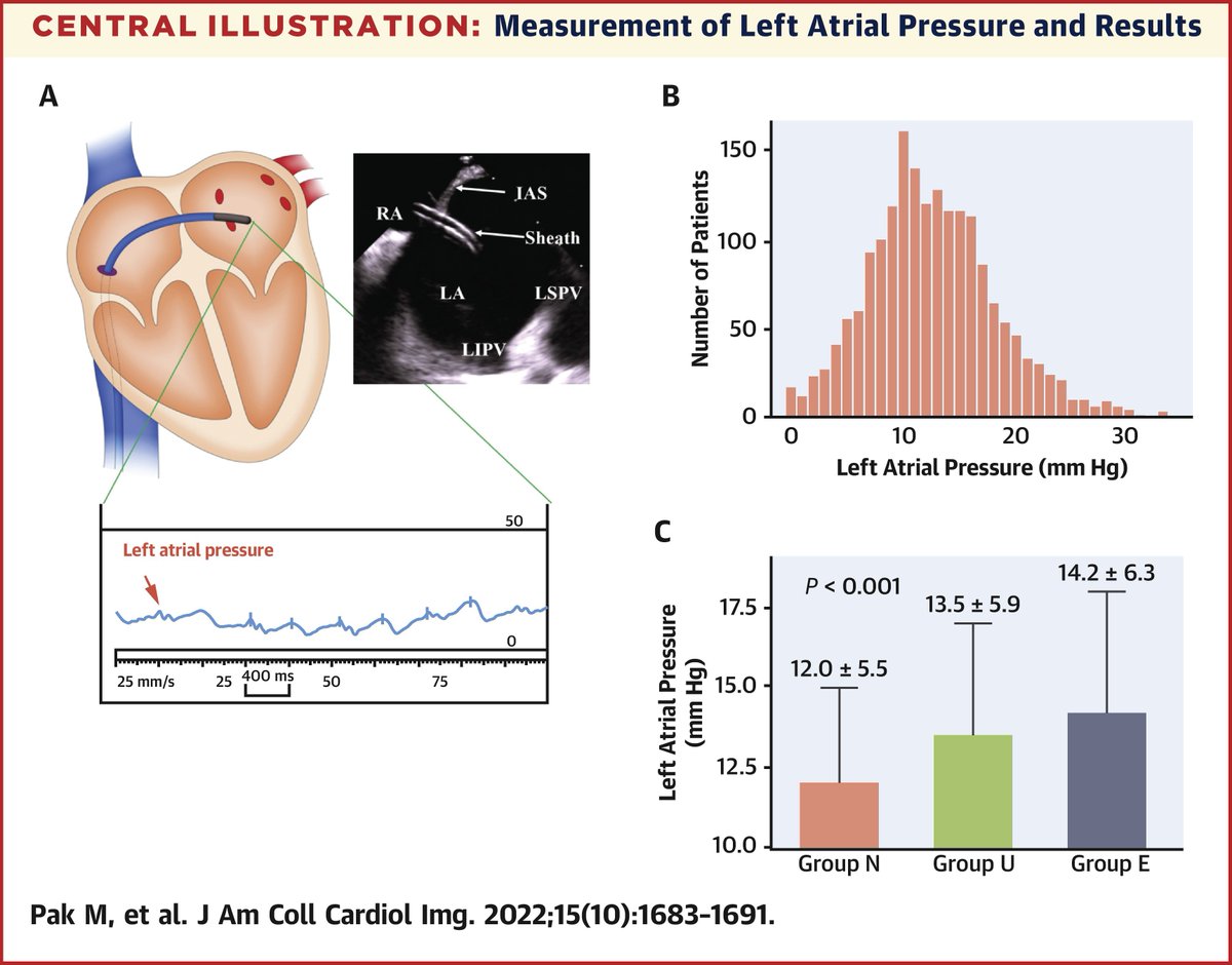 JACCJournals's tweet photo. How well do #Echofirst LV filling pressures as determined by the ASE/EACVI 2016 algorithm actually correlate with directly measured LA pressure at cath? Find out in #JACCIMG: https://t.co/MRLo4tJlfY
#diastology #cvImaing #epAblation #AFib #CardioTwitter https://t.co/hFuPKQFX5C