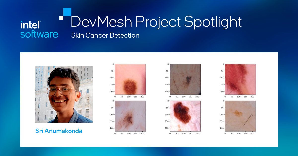 inteldevs's tweet photo. To understand more about neural networks and deep learning algorithms, @srianumakonda developed a learning agent to perform binary classifications on malignant and benign abnormalities. Learn more about the project here: https://t.co/bIf2kQQJ7f #DevMesh https://t.co/bKnn4CotW4