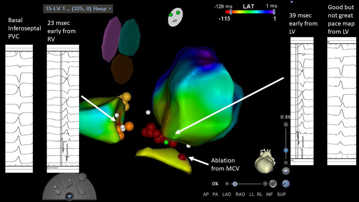 Amit Mehrotra tweet media