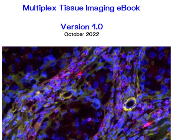 Our new Multiplex Tissue Imaging eBook is now live! In this eBook we discuss the different multiplex approaches, as well as a few unique cases.

Download it here -->hubs.ly/Q01p1FqS0

#Visikol #MultiplexImaging #TissueImaging #TumorImmunology #CancerImmunotherapy