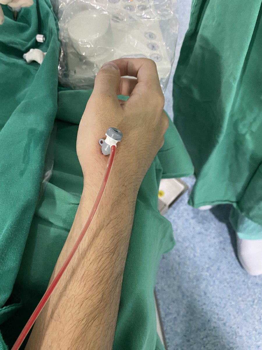 dimitri_zappi's tweet photo. it may even be for the operators, but for the patients the best experience! #dTRAFirst https://t.co/kneem0vaE4