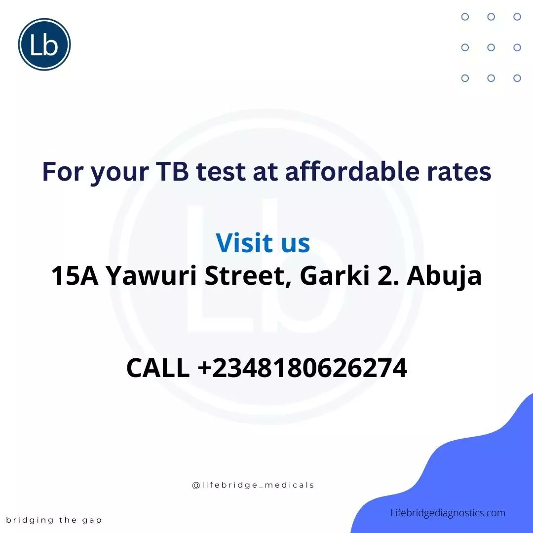 LifebridgeMDC's tweet photo. TB is a contagious disease and could become serious if not diagnosed early.
Visit us for your screening today.
#lifebridge #lifebridgehealth #lifebridgemedicals #abuja #abujaevents #health #tuberculosis #tb #covidtesting #pcrscreening #pcr #diagnostics #abujadoctors #abujanurse https://t.co/GdciaQzni0
