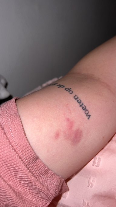 Little polekiss on my arm https://t.co/yfHU2boN9W<a href="/tag/petite"class="tags"><span>#petite</span></a><a href="/tag/usedpanties"class="tags"><span>#usedpanties</span></a><a href="/tag/amateur"class="tags"><span>#amateur</span></a><a href="/tag/pantyselling"class="tags"><span>#pantyselling</span></a>