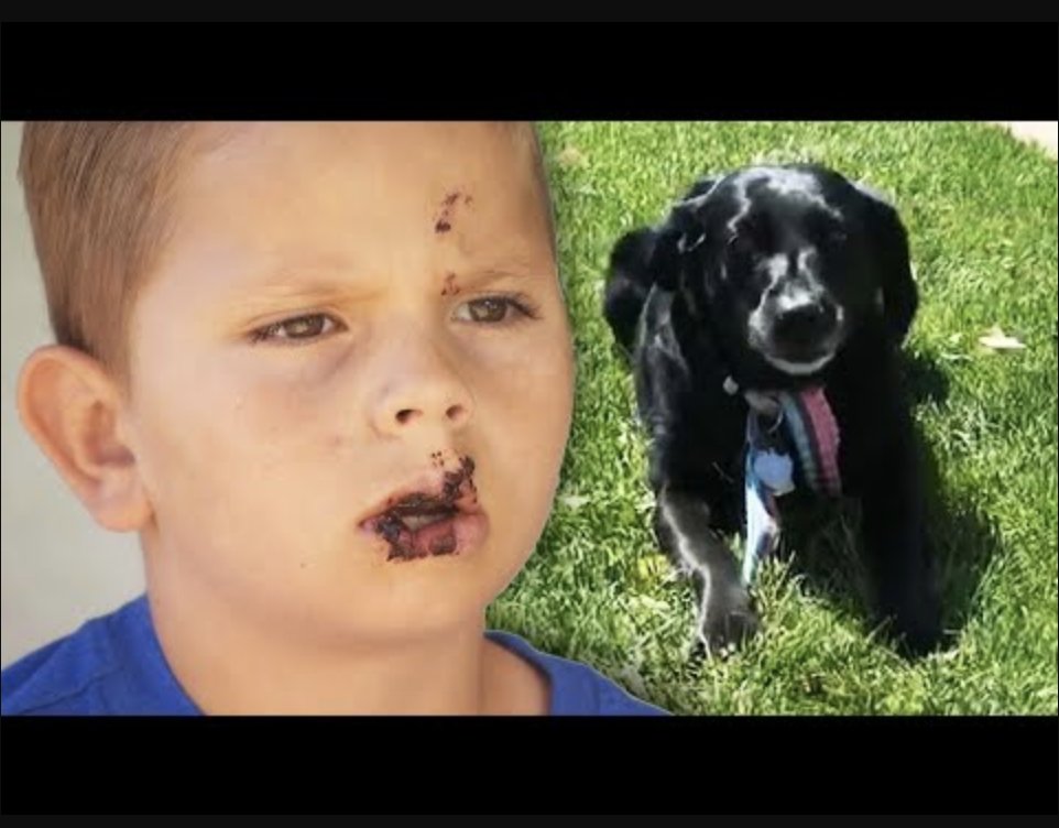 Inside Edition on Twitter "A brave little boy is recovering from a