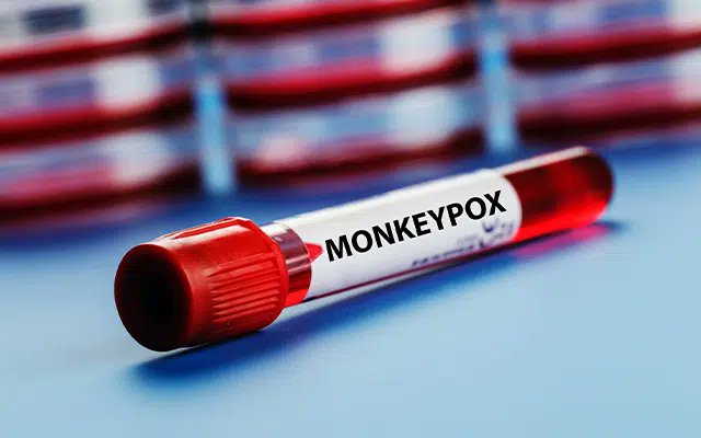 Canada confirms 1,406 monkeypox cases

#newskarnataka #monkeypox #healthagency #canada #confirmcases #LatestNews

To Read More:
newskarnataka.com/world/north-am…
