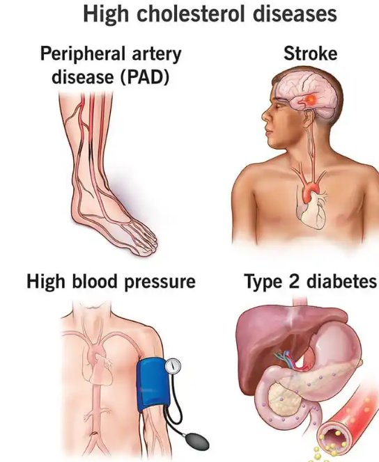 Until it causes other problems in your body, high cholesterol has no symptoms ...

Check your cholesterol level today 🥰🥰
#Health #cholesterol #nurses