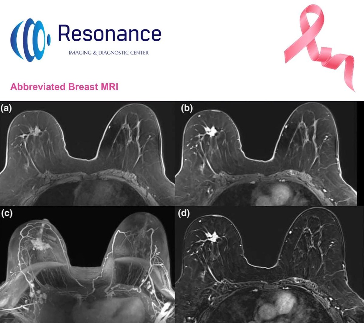 resonanceidc's tweet photo. We at Resonance Imaging and Diagnostic Center have included this #newprotocol called #abbreviatedbreast #MRI (or #ABMRI) in our screening program as a highly sensitive test for #earlydetection of #breastcancer in #densebreasts
#BreastCancerAwarenessMonth https://t.co/NXPc7HtOOK
