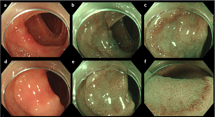 United European Gastroenterology tweet media