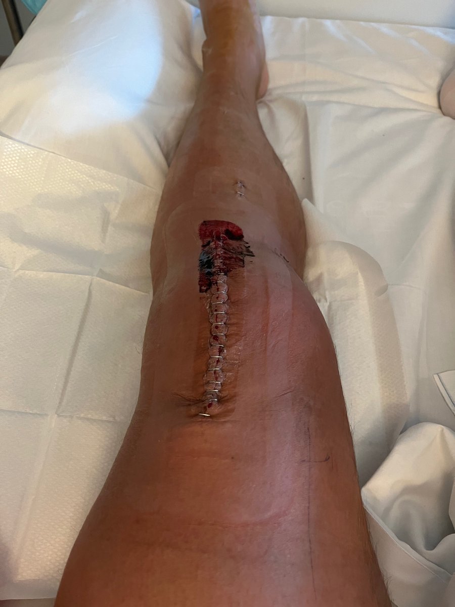 Austin Healey tweet media