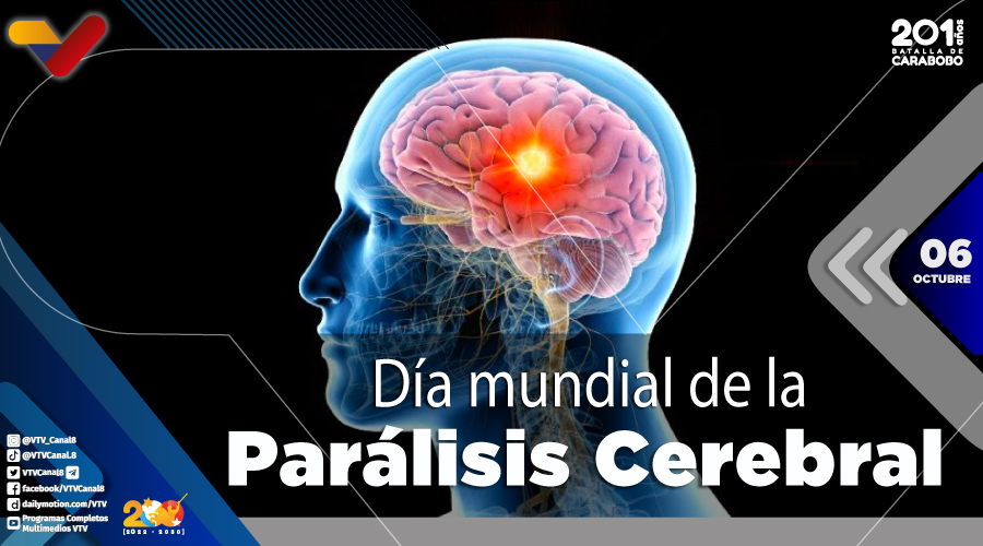 VTVcanal8's tweet photo. #EFEMÉRIDE🗓️| El Día Mundial de la Parálisis Cerebral es una jornada que busca resaltar e identificar las necesidades y limitaciones de esta patología, además de orientar a pacientes y familiares sobre la manera más adecuada de afrontar la enfermedad.
#PuebloConTechoPropio https://t.co/KZoMsOrKRv