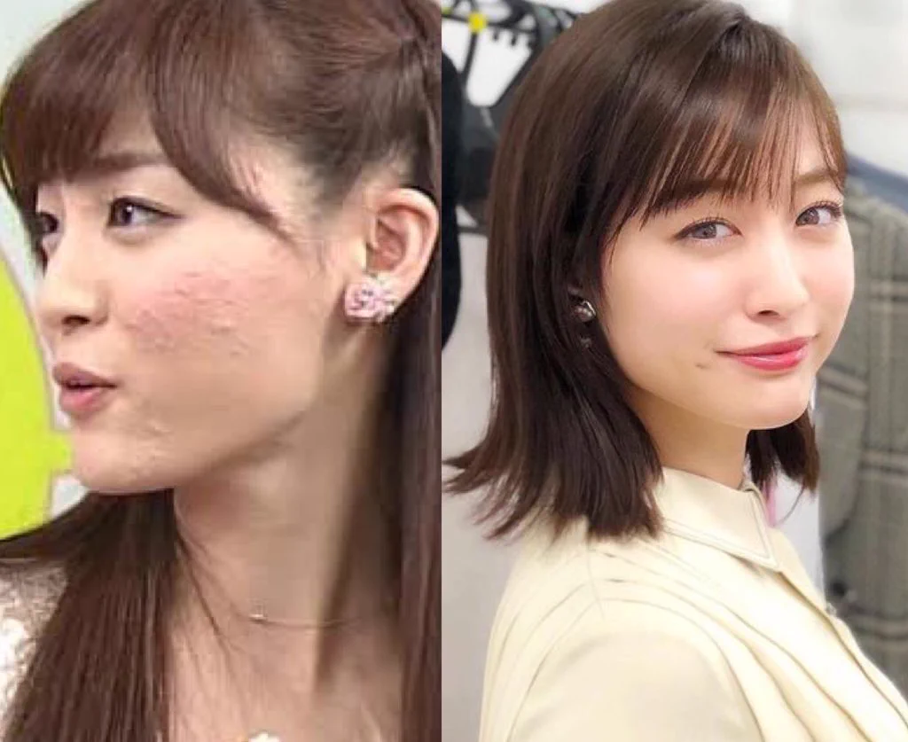 道重さゆみ整形