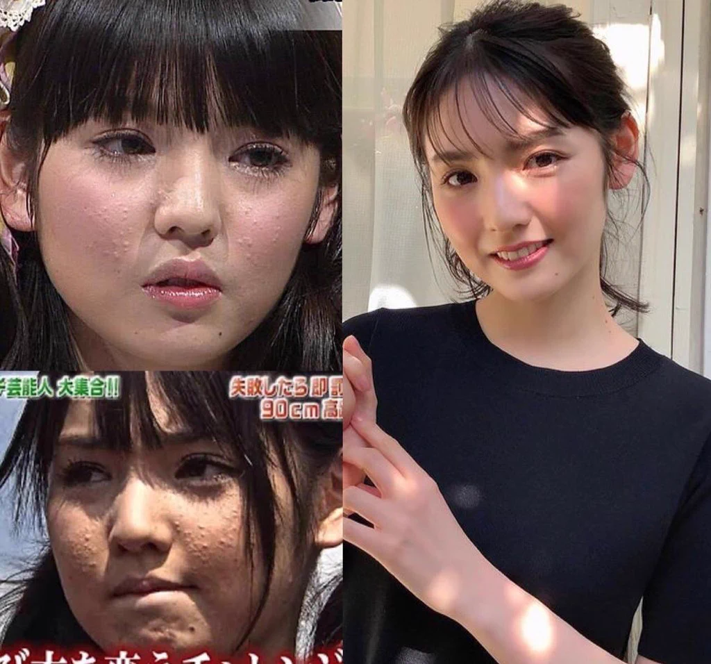 道重 さゆみ 整形